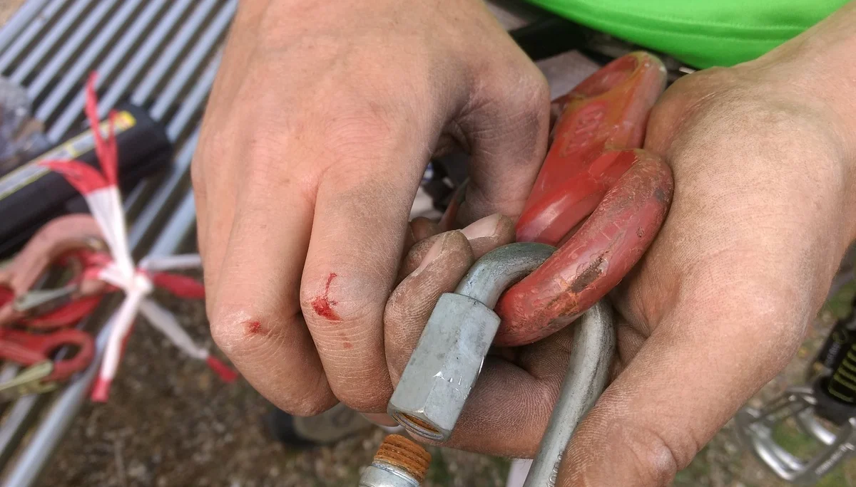 Eine Person hält einen stark beanspruchten Karabinerhaken und Seil mit blutigen Fingern. | © DAV Dortmund